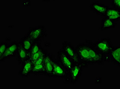 Immunocytochemistry/ Immunofluorescence - Anti-Cdx1 antibody (AB224615)