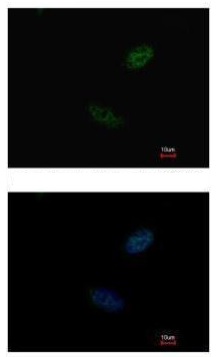 Immunocytochemistry/ Immunofluorescence - Anti-CDX2 antibody (AB227201), expandable thumbnail