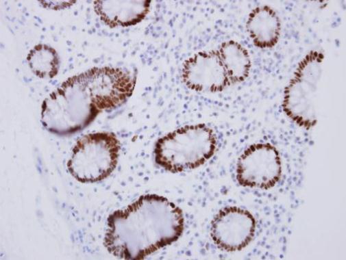 Immunohistochemistry (Formalin/PFA-fixed paraffin-embedded sections) - Anti-CDX2 antibody (AB227201), expandable thumbnail