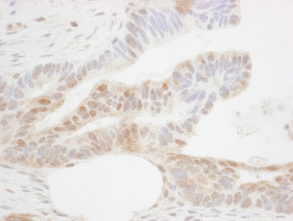Immunohistochemistry (Formalin/PFA-fixed paraffin-embedded sections) - Anti-CDX2 antibody (AB70458)