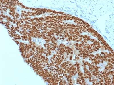 Immunohistochemistry (Formalin/PFA-fixed paraffin-embedded sections) - Anti-CDX2 antibody [CDX2/1690] (AB217884), expandable thumbnail
