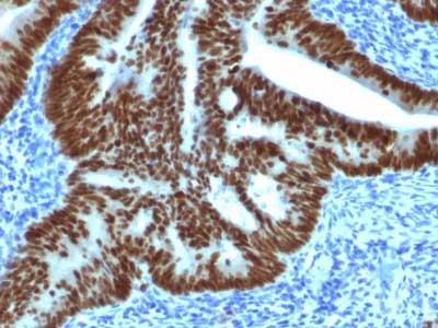 Immunohistochemistry (Formalin/PFA-fixed paraffin-embedded sections) - Anti-CDX2 antibody [CDX2/1690] (AB217884), expandable thumbnail