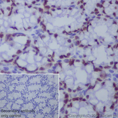 Immunohistochemistry (Formalin/PFA-fixed paraffin-embedded sections) - Anti-CDX2 antibody [EPR2764Y] (AB76541)