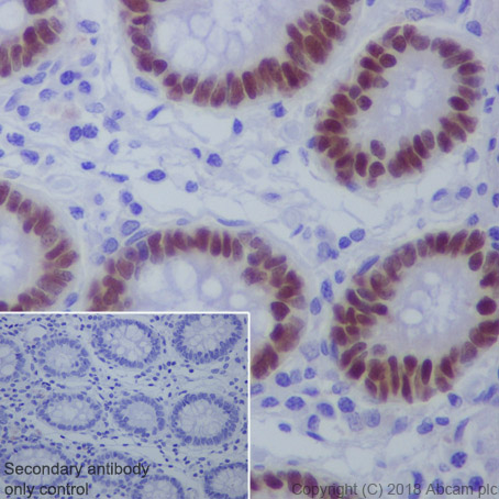 Immunohistochemistry (Formalin/PFA-fixed paraffin-embedded sections) - Anti-CDX2 antibody [EPR2764Y] - BSA and Azide free (AB220799), expandable thumbnail