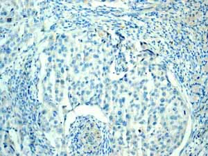 Immunohistochemistry (Formalin/PFA-fixed paraffin-embedded sections) - Anti-CDX2 antibody [EPR2764Y] - BSA and Azide free (AB220799)