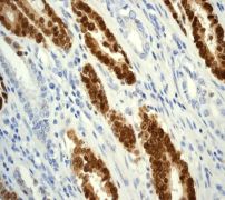 Immunohistochemistry (Formalin/PFA-fixed paraffin-embedded sections) - Anti-CDX2 antibody [EPR2764Y] - BSA and Azide free (ab220799), expandable thumbnail