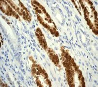 Immunohistochemistry (Formalin/PFA-fixed paraffin-embedded sections) - Anti-CDX2 antibody [EPR2764Y] - BSA and Azide free (AB220799)