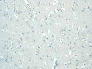 Immunohistochemistry (Formalin/PFA-fixed paraffin-embedded sections) - Anti-CDX2 antibody [EPR2764Y] - BSA and Azide free (ab220799), expandable thumbnail