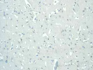 Immunohistochemistry (Formalin/PFA-fixed paraffin-embedded sections) - Anti-CDX2 antibody [EPR2764Y] - BSA and Azide free (AB220799)