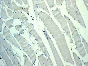 Immunohistochemistry (Formalin/PFA-fixed paraffin-embedded sections) - Anti-CDX2 antibody [EPR2764Y] - BSA and Azide free (ab220799), expandable thumbnail