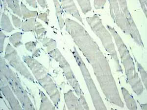 Immunohistochemistry (Formalin/PFA-fixed paraffin-embedded sections) - Anti-CDX2 antibody [EPR2764Y] - BSA and Azide free (AB220799)