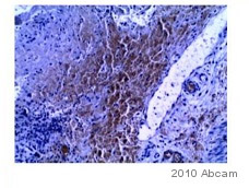 Immunohistochemistry (Formalin/PFA-fixed paraffin-embedded sections) - Anti-CDX2 antibody [EPR2764Y] - BSA and Azide free (AB220799), expandable thumbnail