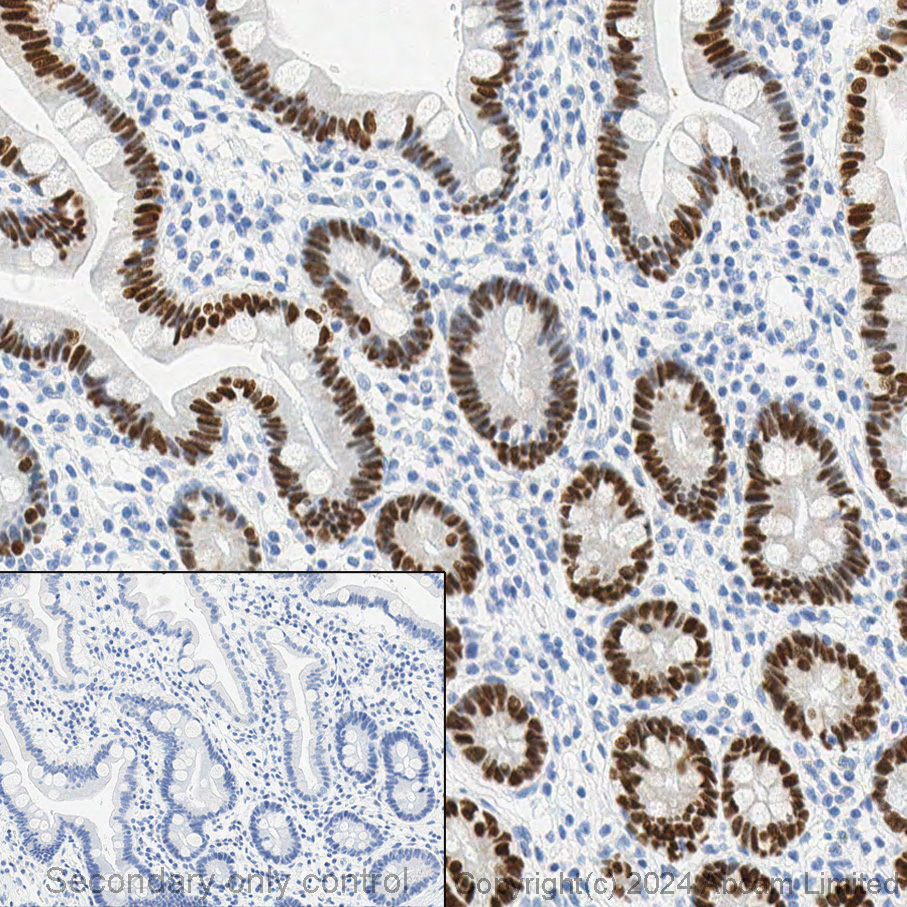 Immunohistochemistry (Formalin/PFA-fixed paraffin-embedded sections) - Anti-CDX2 antibody [EPR2764Y] - BSA and Azide free (ab220799), expandable thumbnail
