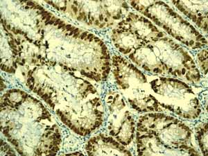 Immunohistochemistry (Formalin/PFA-fixed paraffin-embedded sections) - Anti-CDX2 antibody [EPR2764Y] - BSA and Azide free (ab220799), expandable thumbnail