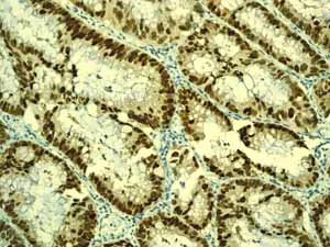 Immunohistochemistry (Formalin/PFA-fixed paraffin-embedded sections) - Anti-CDX2 antibody [EPR2764Y] - BSA and Azide free (AB220799)