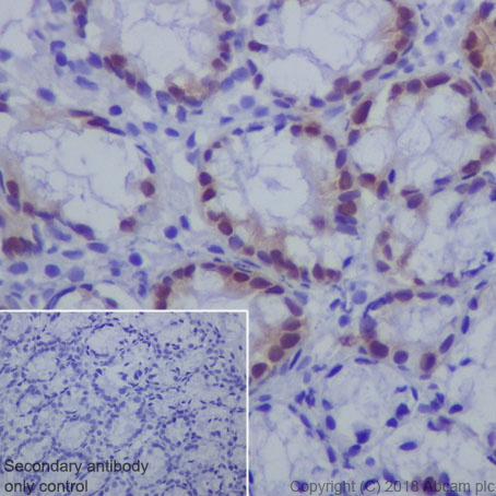 Immunohistochemistry (Formalin/PFA-fixed paraffin-embedded sections) - Anti-CDX2 antibody [EPR2764Y] - BSA and Azide free (AB220799), expandable thumbnail