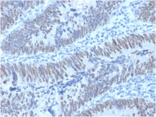 Immunohistochemistry (Formalin/PFA-fixed paraffin-embedded sections) - Anti-CDX2 antibody [PCRP-CDX2-1A3] (AB236536)