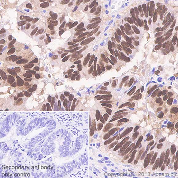 Immunohistochemistry (Formalin/PFA-fixed paraffin-embedded sections) - Anti-CDX2 antibody [SP54] (AB101532), expandable thumbnail