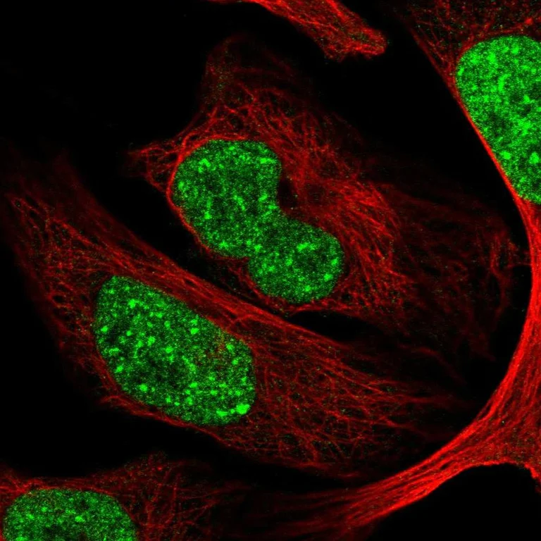 Immunocytochemistry/ Immunofluorescence - Anti-CDYL antibody (AB251838)