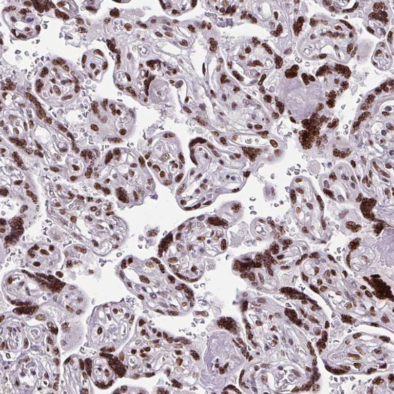 Immunohistochemistry (Formalin/PFA-fixed paraffin-embedded sections) - Anti-CDYL antibody (AB251838)