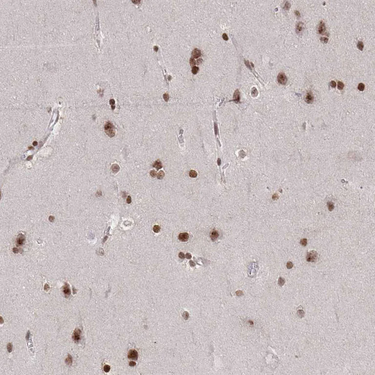 Immunohistochemistry (Formalin/PFA-fixed paraffin-embedded sections) - Anti-CDYL antibody (AB251838)