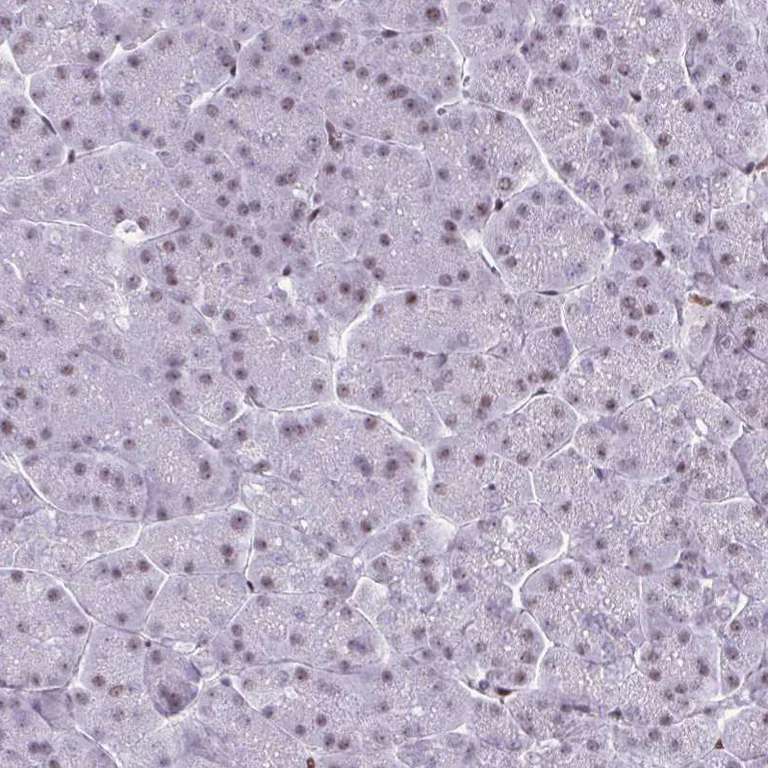 Immunohistochemistry (Formalin/PFA-fixed paraffin-embedded sections) - Anti-CDYL antibody (AB251838)