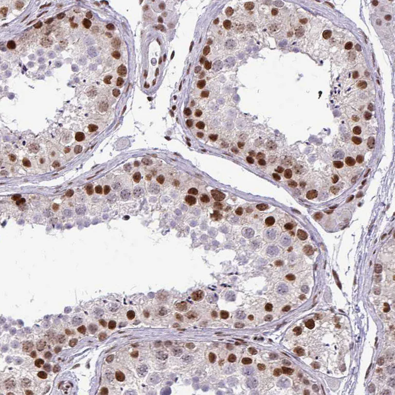 Immunohistochemistry (Formalin/PFA-fixed paraffin-embedded sections) - Anti-CDYL antibody (AB251838)