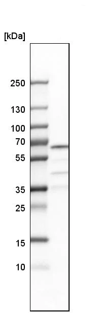 Western blot - Anti-CDYL antibody (AB251838)