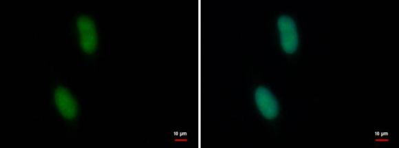 Immunocytochemistry/ Immunofluorescence - Anti-CDYL2 antibody (AB183854)