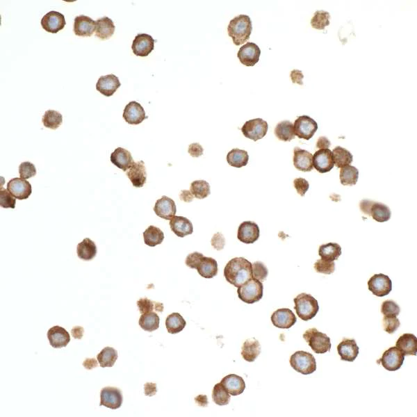 Immunocytochemistry - Anti-CEACAM1 antibody [BLR032F] (AB243889)