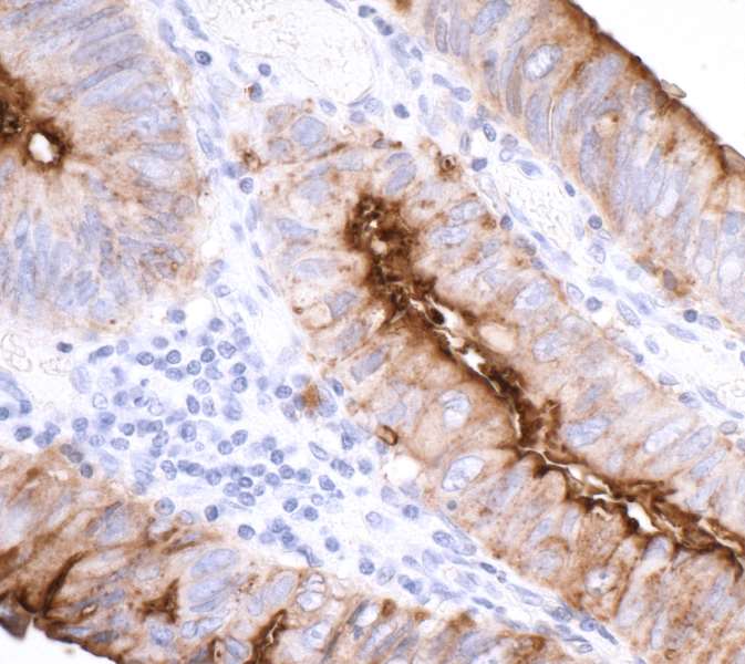 Immunohistochemistry (Formalin/PFA-fixed paraffin-embedded sections) - Anti-CEACAM1 antibody [BLR032F] (AB243889)