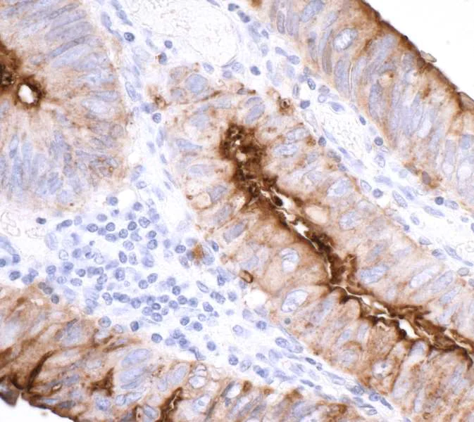 Immunohistochemistry (Formalin/PFA-fixed paraffin-embedded sections) - Anti-CEACAM1 antibody [BLR032F] (AB243889)