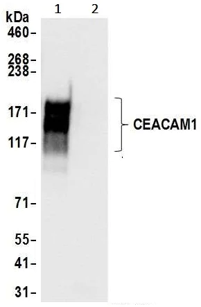 Immunoprecipitation - Anti-CEACAM1 antibody [BLR032F] (AB243889)