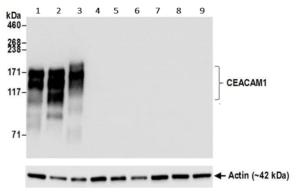 Western blot - Anti-CEACAM1 antibody [BLR032F] (AB243889)