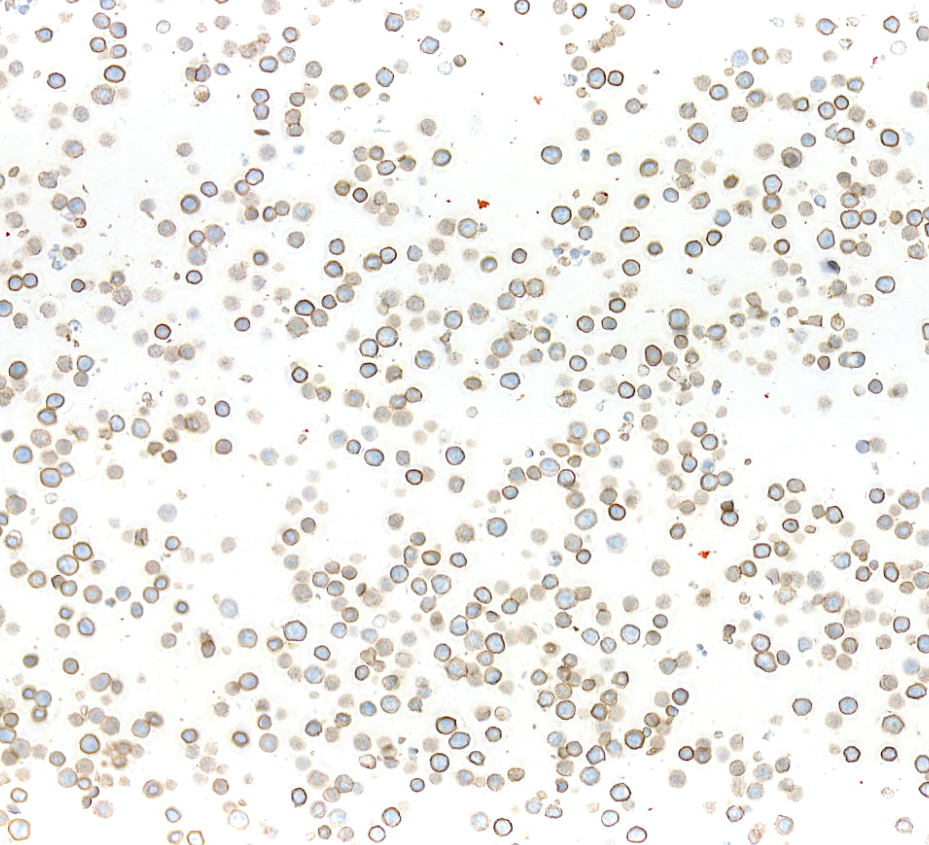 Immunocytochemistry - Anti-CEACAM1 antibody [BLR240L] - BSA free (AB314050), expandable thumbnail
