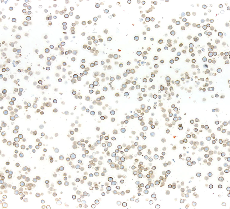 Immunocytochemistry - Anti-CEACAM1 antibody [BLR240L] - BSA free (AB314050)