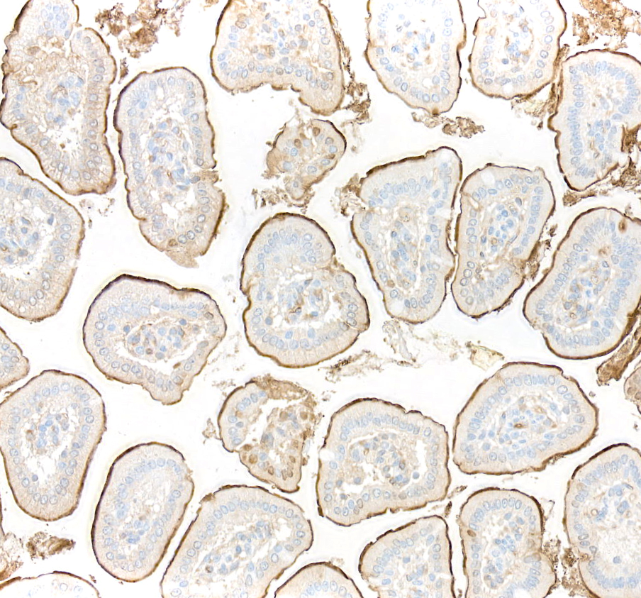 Immunohistochemistry (Formalin/PFA-fixed paraffin-embedded sections) - Anti-CEACAM1 antibody [BLR240L] - BSA free (AB314050), expandable thumbnail