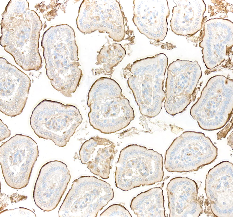 Immunohistochemistry (Formalin/PFA-fixed paraffin-embedded sections) - Anti-CEACAM1 antibody [BLR240L] - BSA free (AB314050)