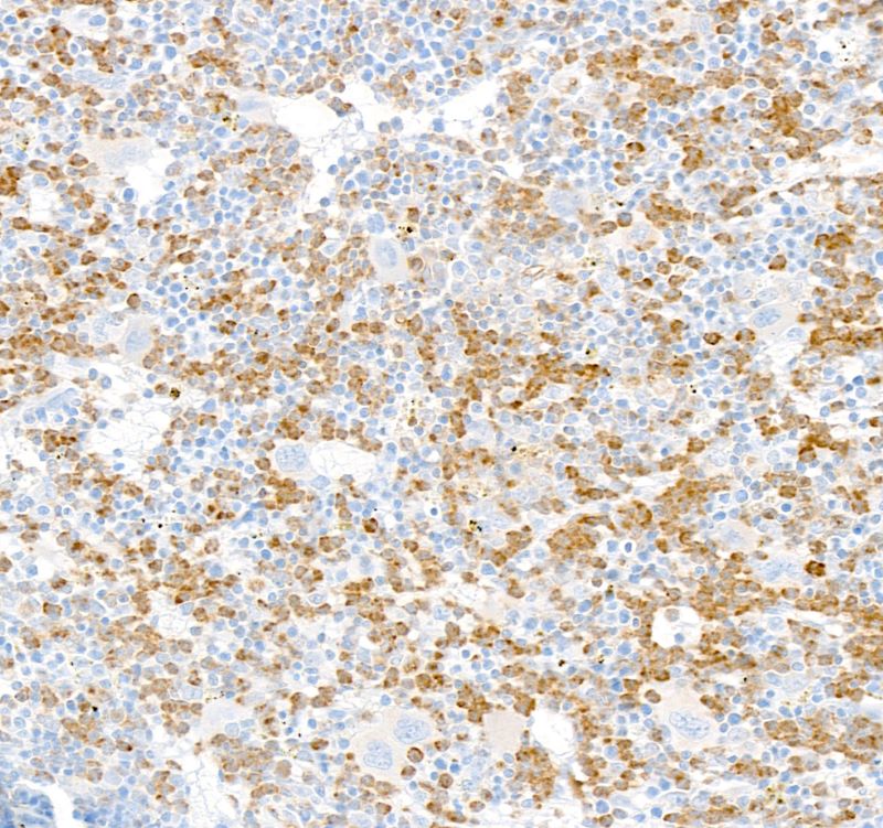 Immunohistochemistry (Formalin/PFA-fixed paraffin-embedded sections) - Anti-CEACAM1 antibody [BLR240L] - BSA free (AB314050), expandable thumbnail
