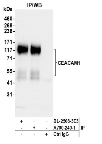 Immunoprecipitation - Anti-CEACAM1 antibody [BLR240L] - BSA free (AB314050), expandable thumbnail