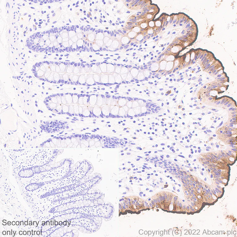 Immunohistochemistry (Formalin/PFA-fixed paraffin-embedded sections) - Anti-CEACAM1 antibody [EPR26490-88] (AB300061)