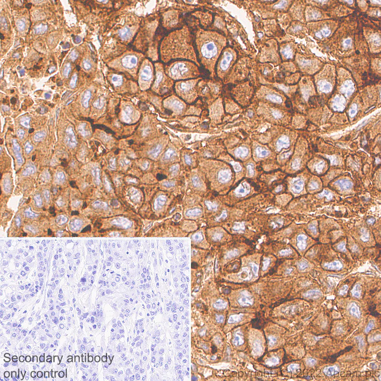 Immunohistochemistry (Formalin/PFA-fixed paraffin-embedded sections) - Anti-CEACAM1 antibody [EPR26490-88] (AB300061)
