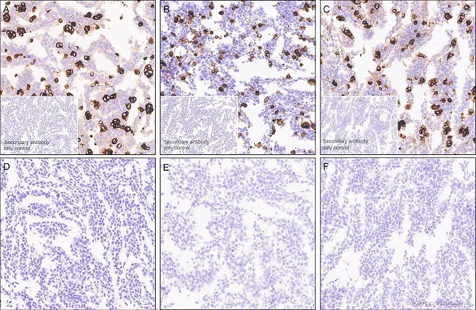 Immunohistochemistry (Formalin/PFA-fixed paraffin-embedded sections) - Anti-CEACAM1 antibody [EPR4048] (AB108390)