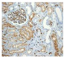 Immunohistochemistry (Formalin/PFA-fixed paraffin-embedded sections) - Anti-CEACAM1 antibody [EPR4048] - BSA and Azide free (AB179460)
