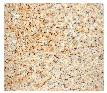 Immunohistochemistry (Formalin/PFA-fixed paraffin-embedded sections) - Anti-CEACAM1 antibody [EPR4048] - BSA and Azide free (AB179460)