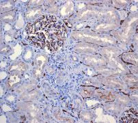 Immunohistochemistry (Formalin/PFA-fixed paraffin-embedded sections) - Anti-CEACAM1 antibody [EPR4049] (AB108397)