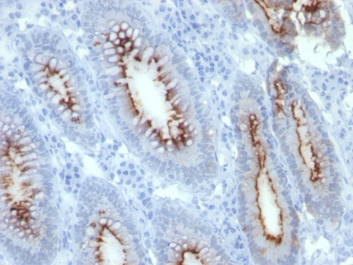 Immunohistochemistry (Formalin/PFA-fixed paraffin-embedded sections) - Anti-CEACAM1 + CEACAM5 antibody [C66/261] (AB190718), expandable thumbnail