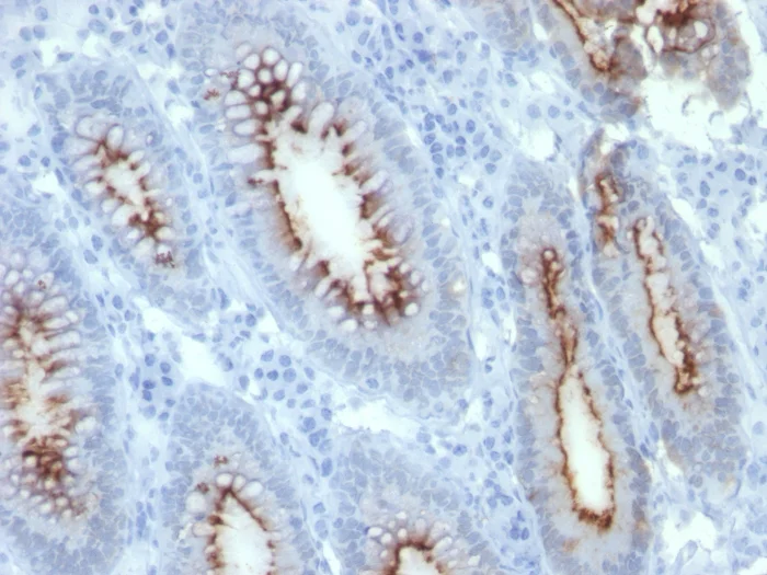 Immunohistochemistry (Formalin/PFA-fixed paraffin-embedded sections) - Anti-CEACAM1 + CEACAM5 antibody [C66/261] (AB190718)