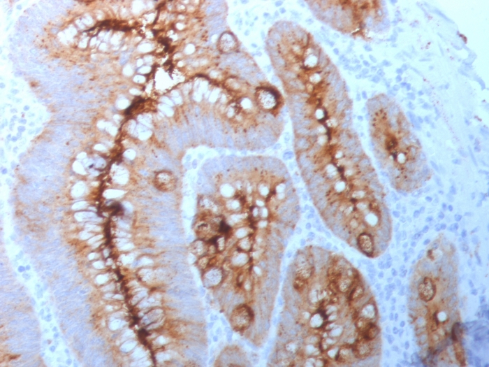 Immunohistochemistry (Formalin/PFA-fixed paraffin-embedded sections) - Anti-CEACAM1 + CEACAM5 antibody [C66/261] (AB190718), expandable thumbnail