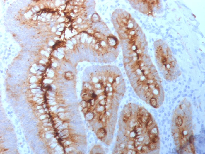 Immunohistochemistry (Formalin/PFA-fixed paraffin-embedded sections) - Anti-CEACAM1 + CEACAM5 antibody [C66/261] (AB190718)